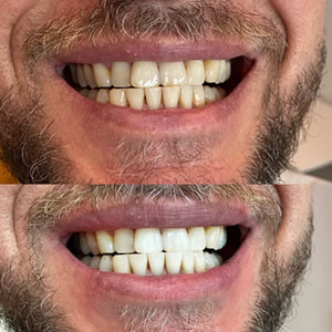 cosmetic dental before after