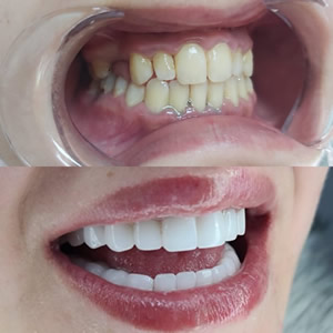 dental before after