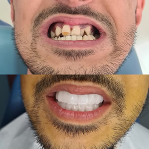 dental cosmetic before after